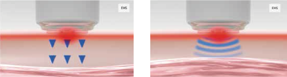 EMS